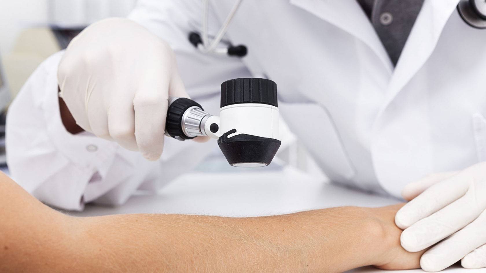 Лечение меланомы: методы борьбы с онкопатологией кожи в германии